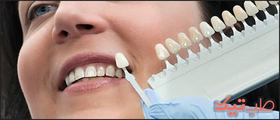 دندان‌پزشکان بخوانند، مناسب‌ترین کامپوزیت برای بیمار من کدام است؟