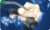 تصویر  Filtek™ Bulk Fill Flow