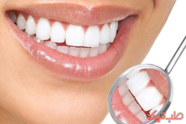 معاینه دوره ای دندان ها